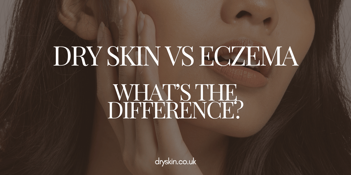 Dry Skin vs Eczema
