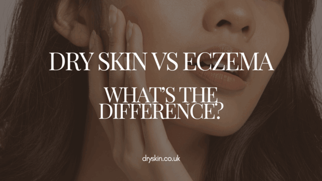 Dryskin – Dry Skin vs Eczema Dry Skin vs Eczema