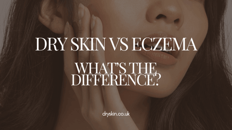 Dry Skin vs Eczema